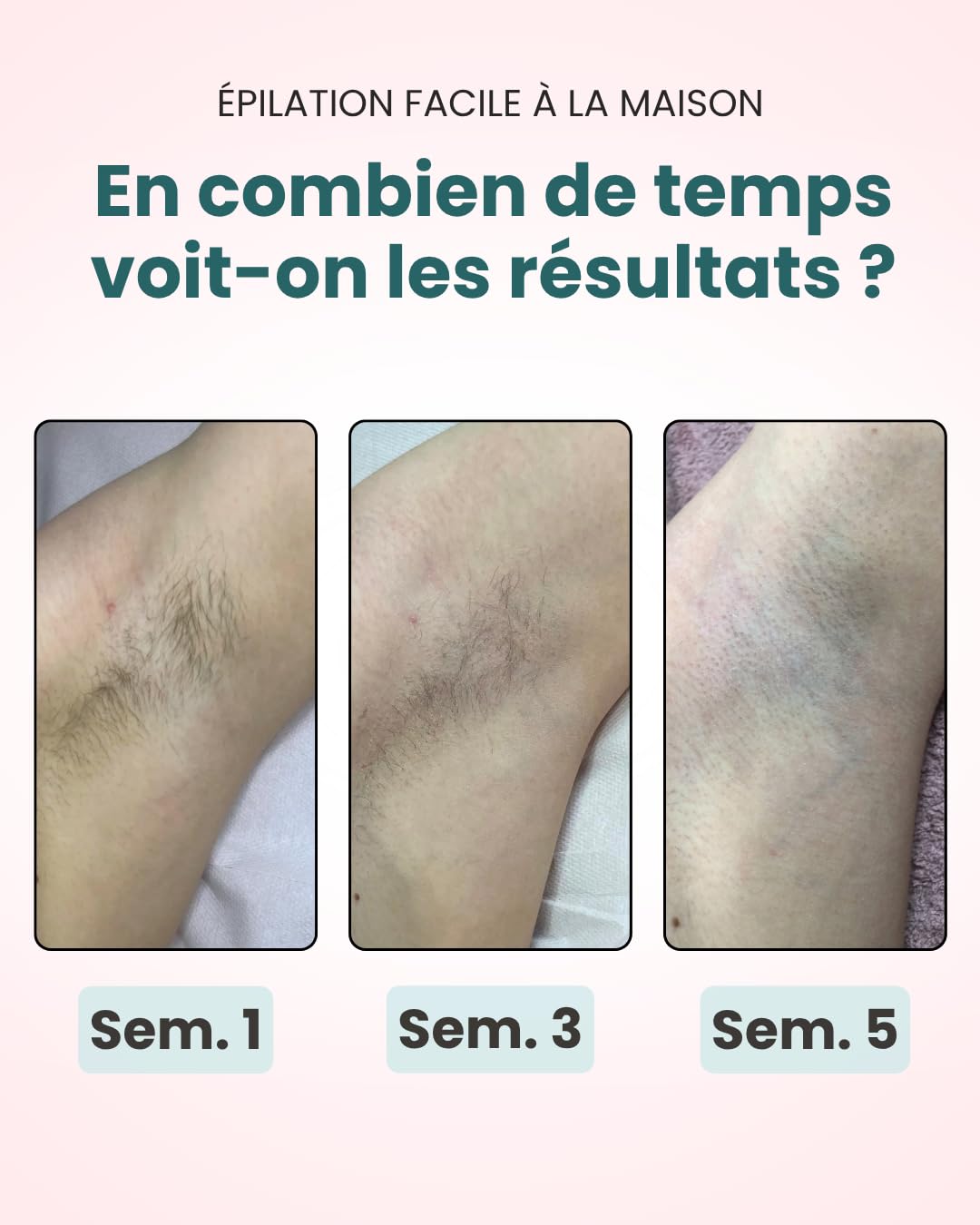 KISMI Pro Pack Professionnel - Épilateur IPL Lumière Pulsée Ice-Cool, 999 999 Flashs, 6 Niveaux, Rasoir Électrique + Lunettes Inclus, Visage Corps Maillot, Femme & Homme