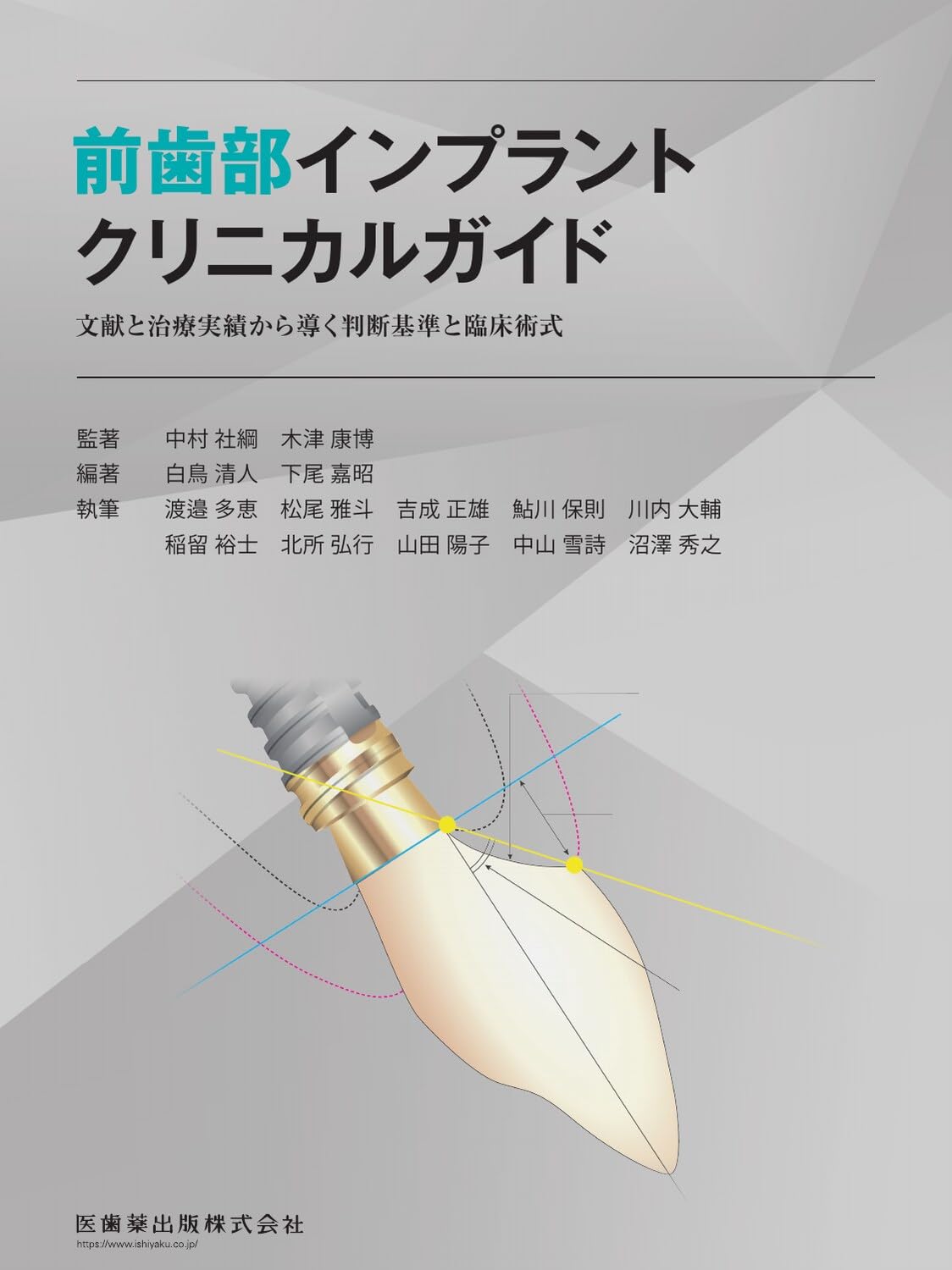前歯部インプラントクリニカルガイド: 文献と治療実績から導く判断基準