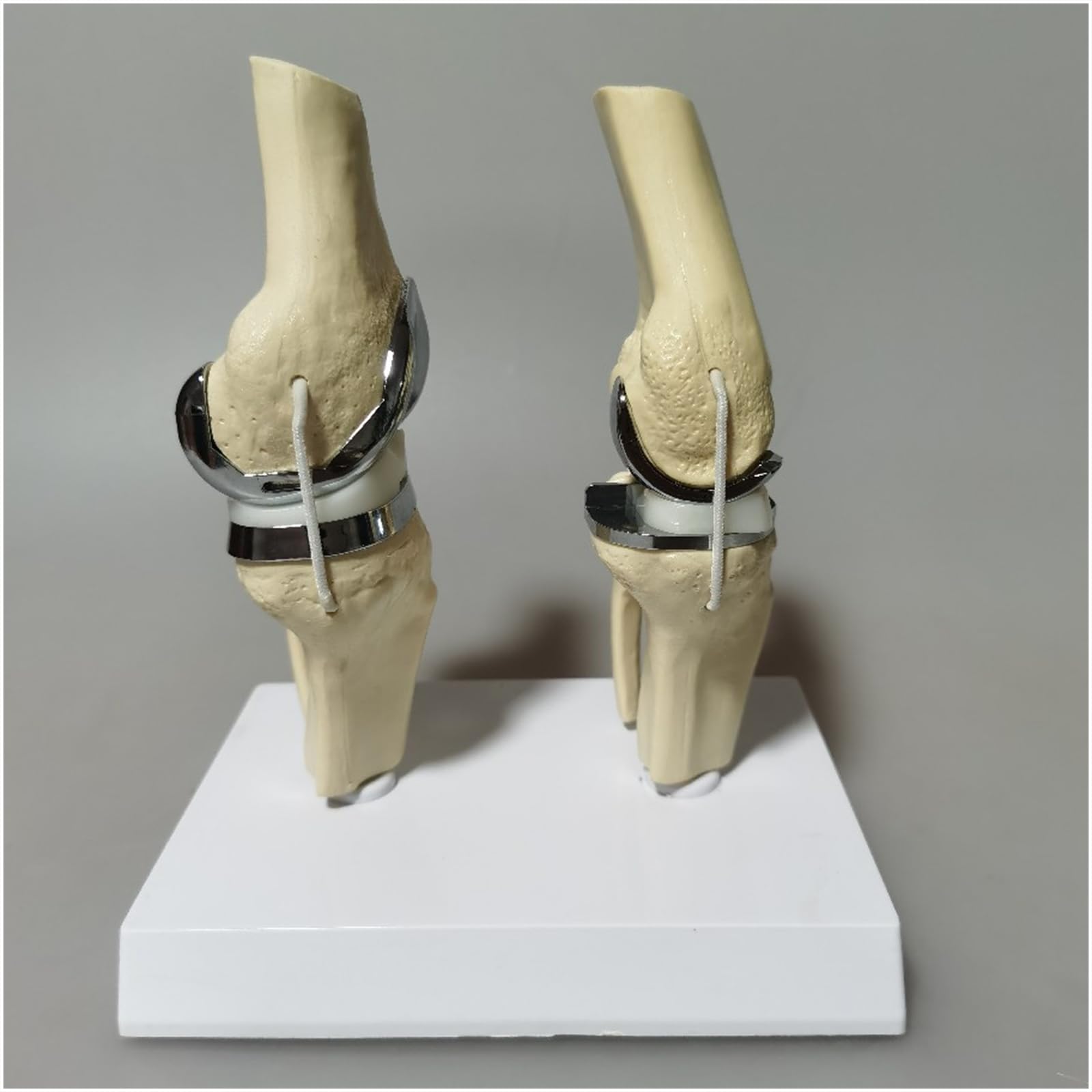 Modello di Protesi articolare del Ginocchio con cartilagine Artificiale Modello di Protesi per Chirurgo Ortopedico clinico Modello di Comunicazione con Il paziente,Bianca,20cm