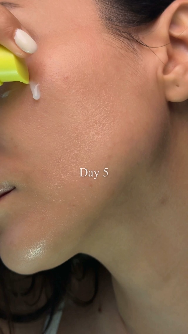 Amazon.com: Lemonderma Lemonshot Anti-Aging Serum for Sensitive