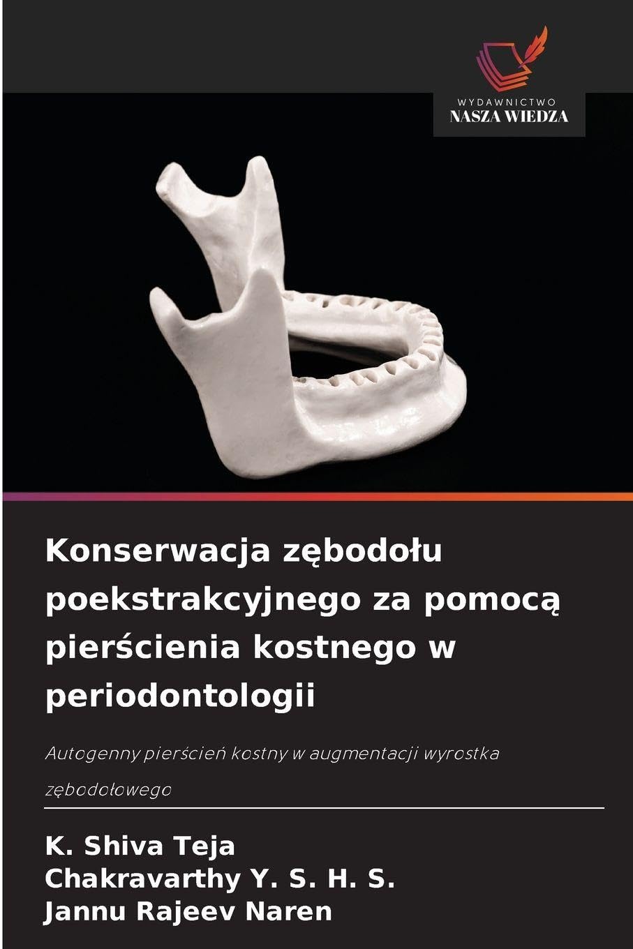 Konserwacja zębodolu poekstrakcyjnego za pomocą pierścienia kostnego w periodontologii: Autogenny pier¿cie¿ kostny w augmentacji wyrostka z¿bodo¿owego