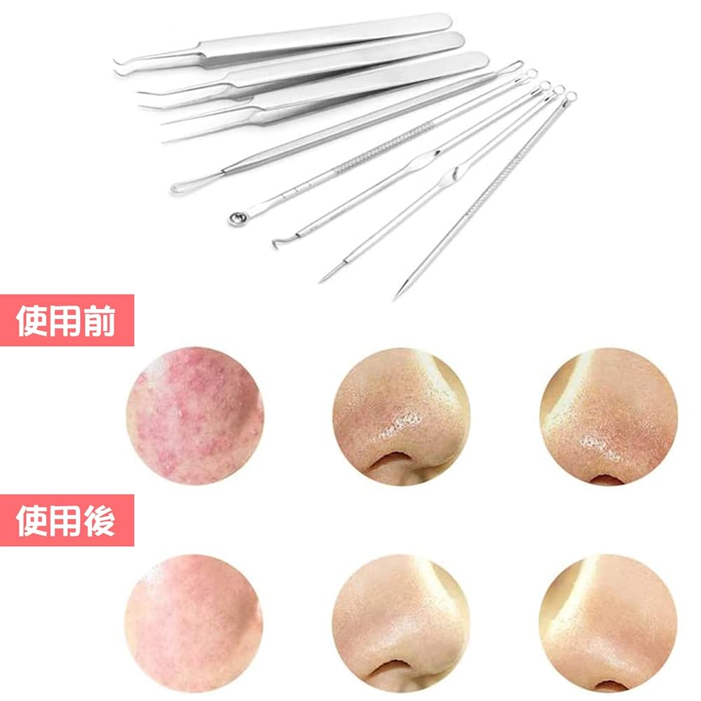 Amazon.co.jp: Coollooda 角栓 ピンセット 8本 かくせんとり