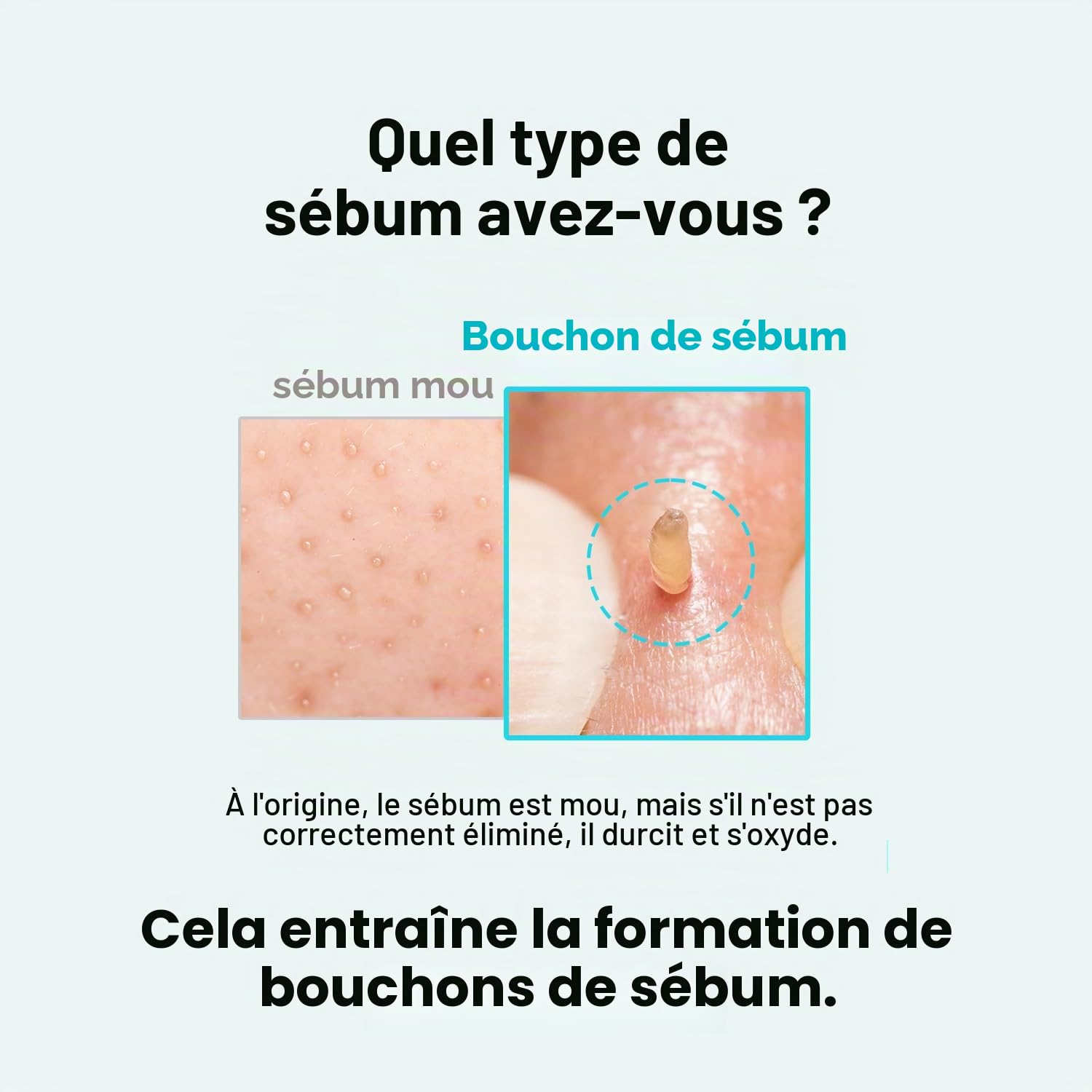 ILSO Super Melting Sebum Adoucissant 156 ml avec 40 cotons inclus