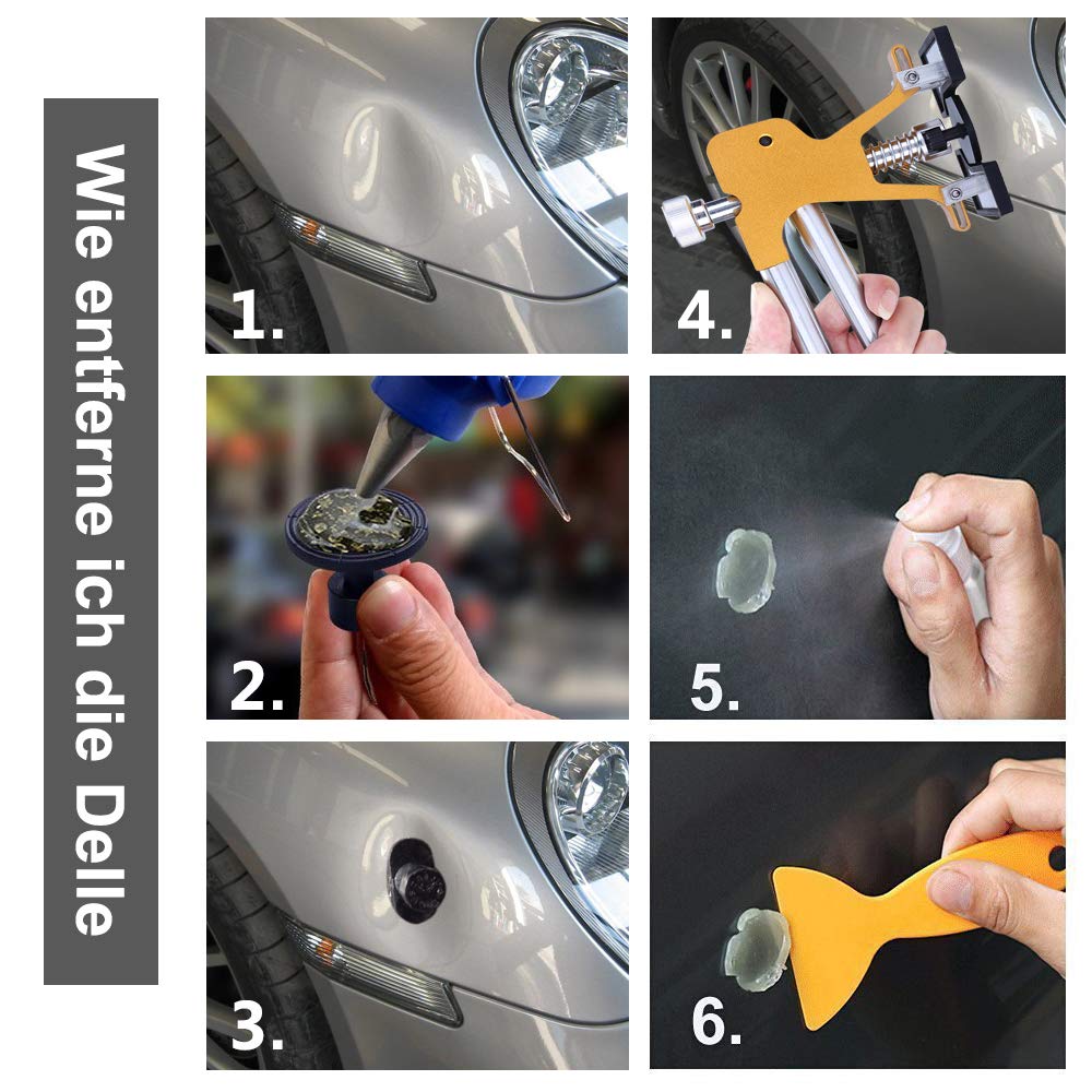 Manelord Dellen Reparatur Ausbeulwerkzeug Lackfreies Dellen Reparaturset Dent Puller Set