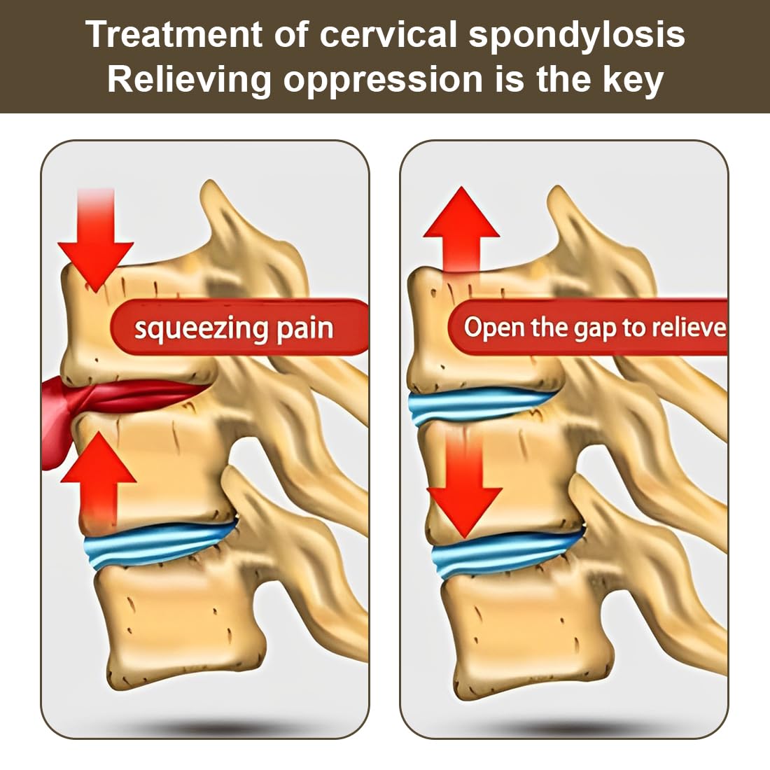 Dispositif de Traction du Cou Cervical, Tracteur de Vertèbre Cervicale Ménager, Dispositif de Traction de Fixation de Soutien du Cou pour Soulager la Douleur des Maux de Cou(Gris