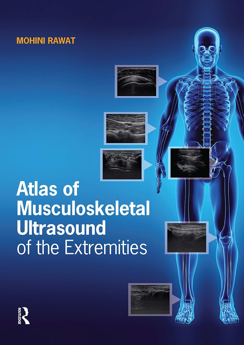 Atlas of Musculoskeletal Ultrasound of the Extremities