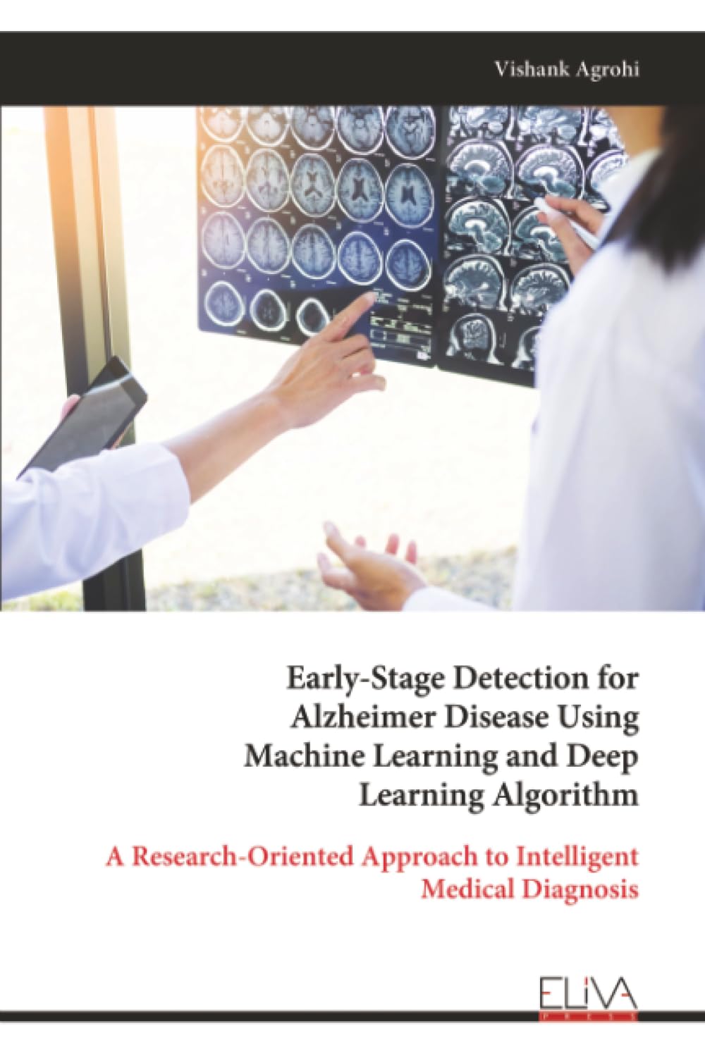 Early-Stage Detection for Alzheimer Disease Using Machine Learning and Deep Learning Algorithm: A Research-Oriented Approach to Intelligent Medical Diagnosis