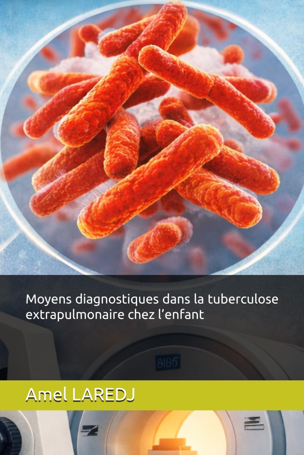 Moyens Diagnostiques Dans La Tuberculose Extra-Pulmonaire Chez L’enfant