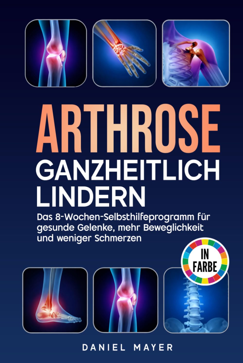 Arthrose ganzheitlich lindern: Das 8-Wochen-Selbsthilfeprogramm für gesunde Gelenke, mehr Beweglichkeit und weniger Schmerzen