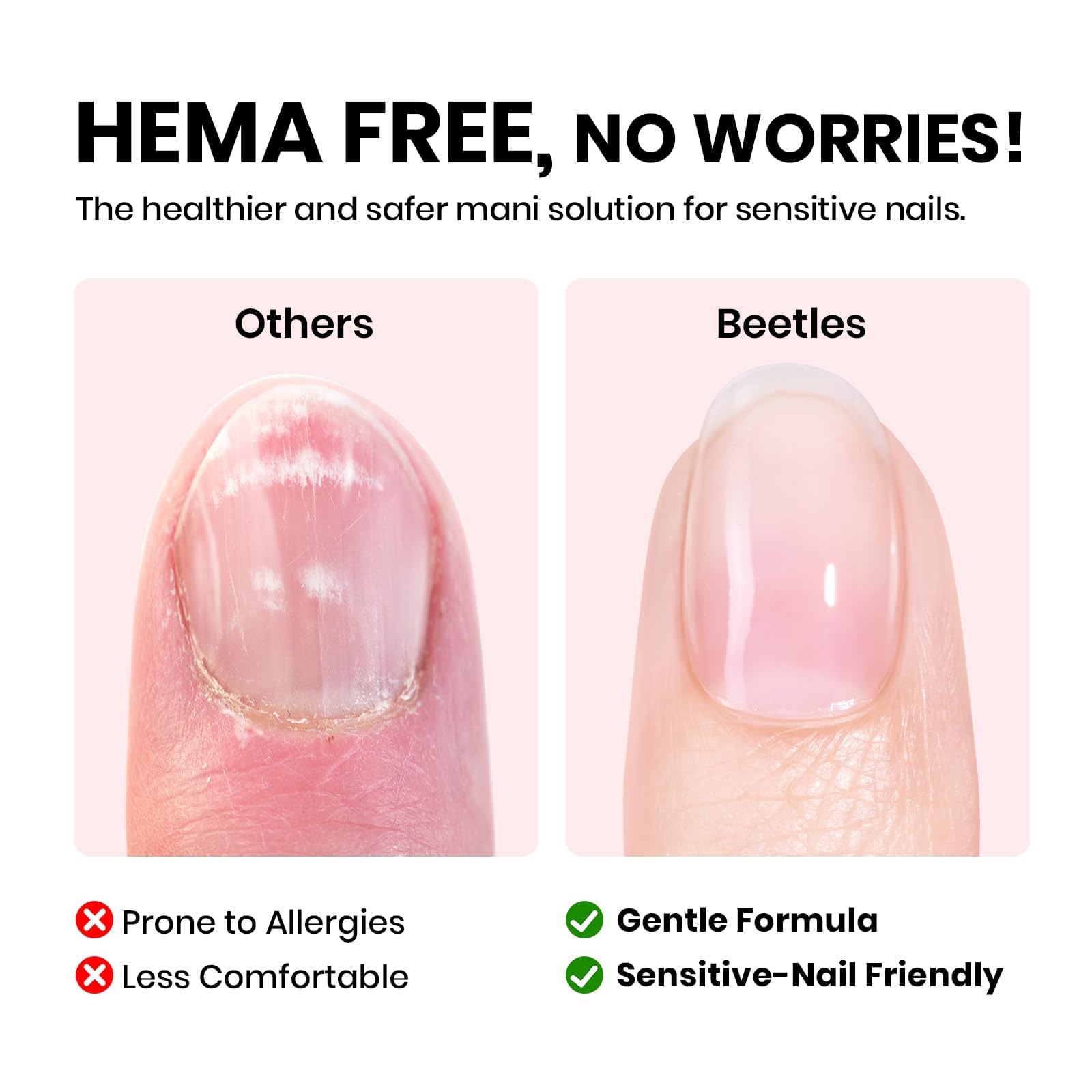 Beetles - Gel constructor sin HEMA con base y capa superior que no se limpia 3 unidades, 15 ml | Acabado brillante de uñas y fórmula de baja sensibilidad mejorada de larga duración para mujeres
