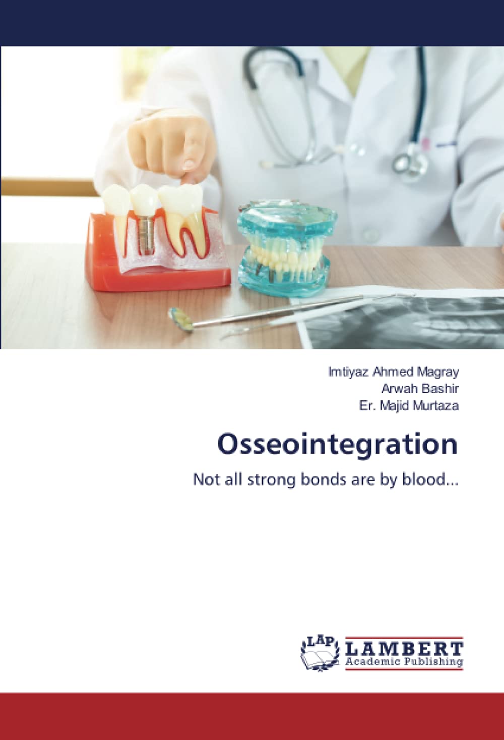 Osseointegration