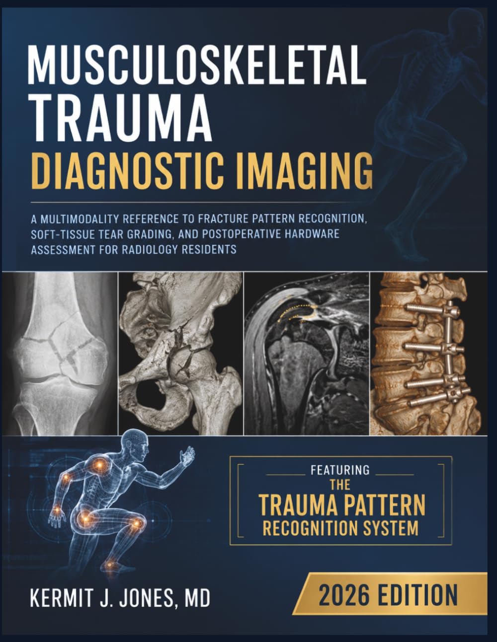 Musculoskeletal Trauma Diagnostic Imaging 2026: A Multimodality Reference to Fracture Pattern Recognition, Soft-Tissue Tear Grading, and Postoperative Hardware Assessment for Radiology Residents