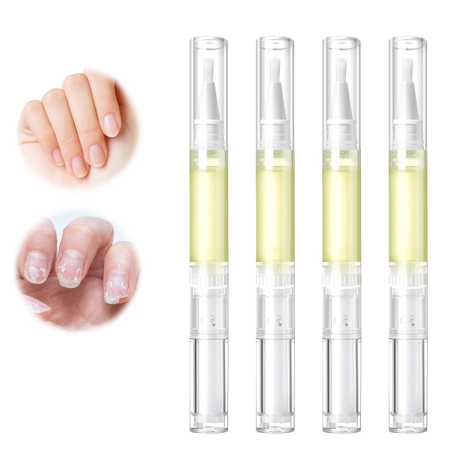Nailz Nail ???????????????????????? Pen,Radiant Nail Growth GIL,Radiant Nail Growth Oil Pen,Cuticle Oil for Nails,Nail Strengthener, for Moisturize Strengthen Nail Care,Finger Edge Manicure Nourishing Pen(4PCS)
