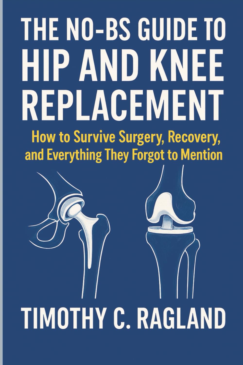 THE NO-BS GUIDE TO HIP AND KNEE REPLACEMENT: How to Survive Surgery, Recovery, and Everything They Forgot to Mention