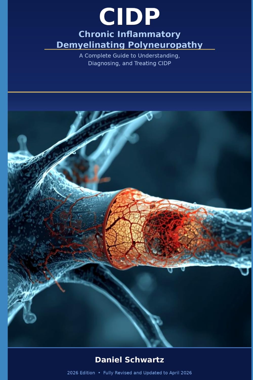 CIDP - Chronic Inflammatory Demyelinating Polyneuropathy: A Complete Guide to Understanding, Diagnosing, and Treating CIDP (Medicine, Health, and Self-Help)
