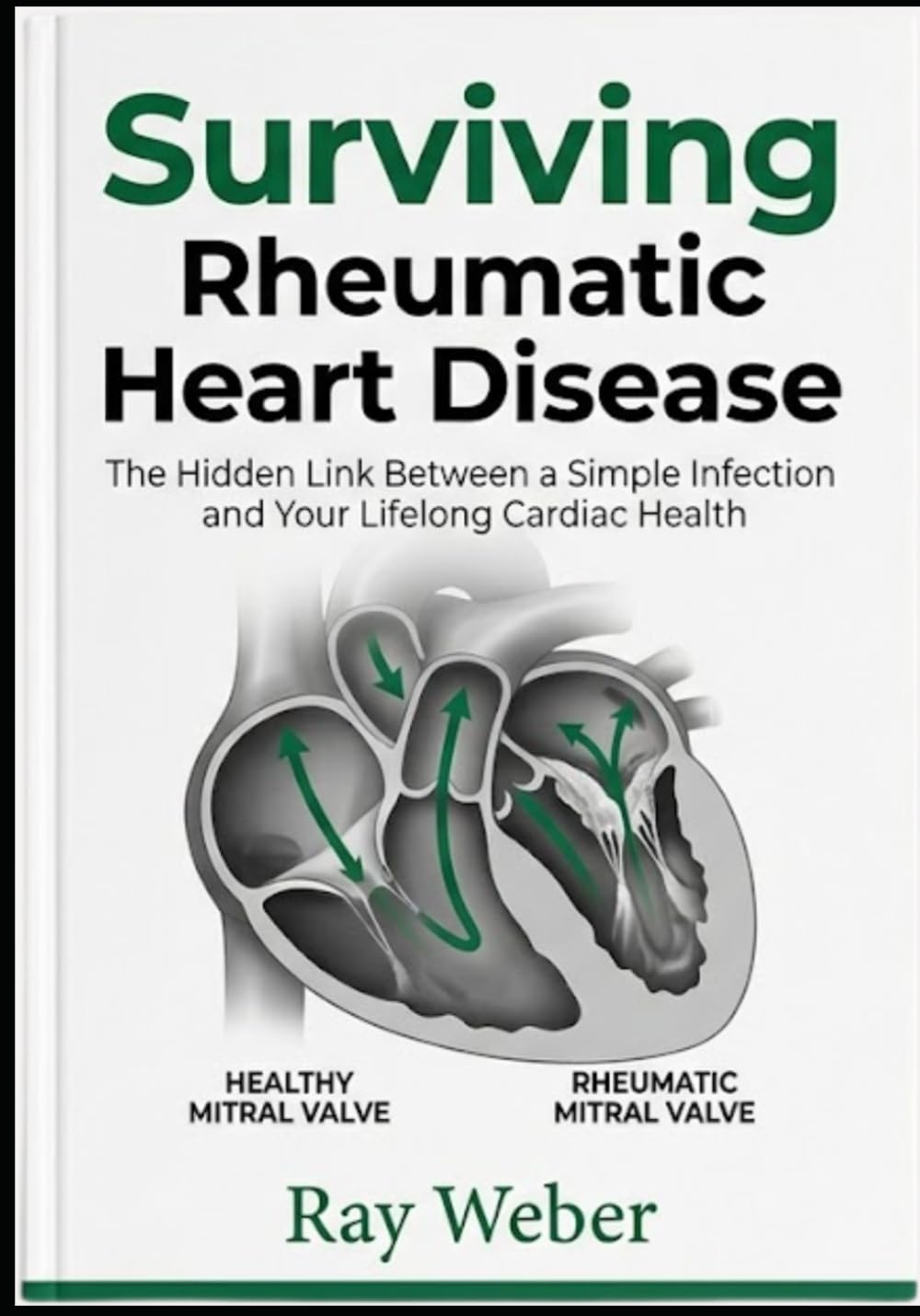 Surviving Rheumatic Heart Disease: The Hidden Link Between a Simple Infection and Your Lifelong Cardiac Health (The Heart Health Survival Guide ... your heart. Protect your heart. Live longer.)