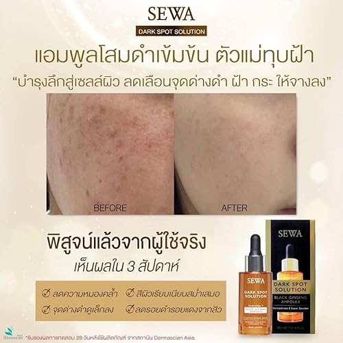 Miniatura 3 de Sewa Dark Spot Solution - Ampolla de ginseng negro concentrado y Super Booster de 1.0fl oz. Tratamiento de malasma, 1.01 onzas líquidas (paquete de