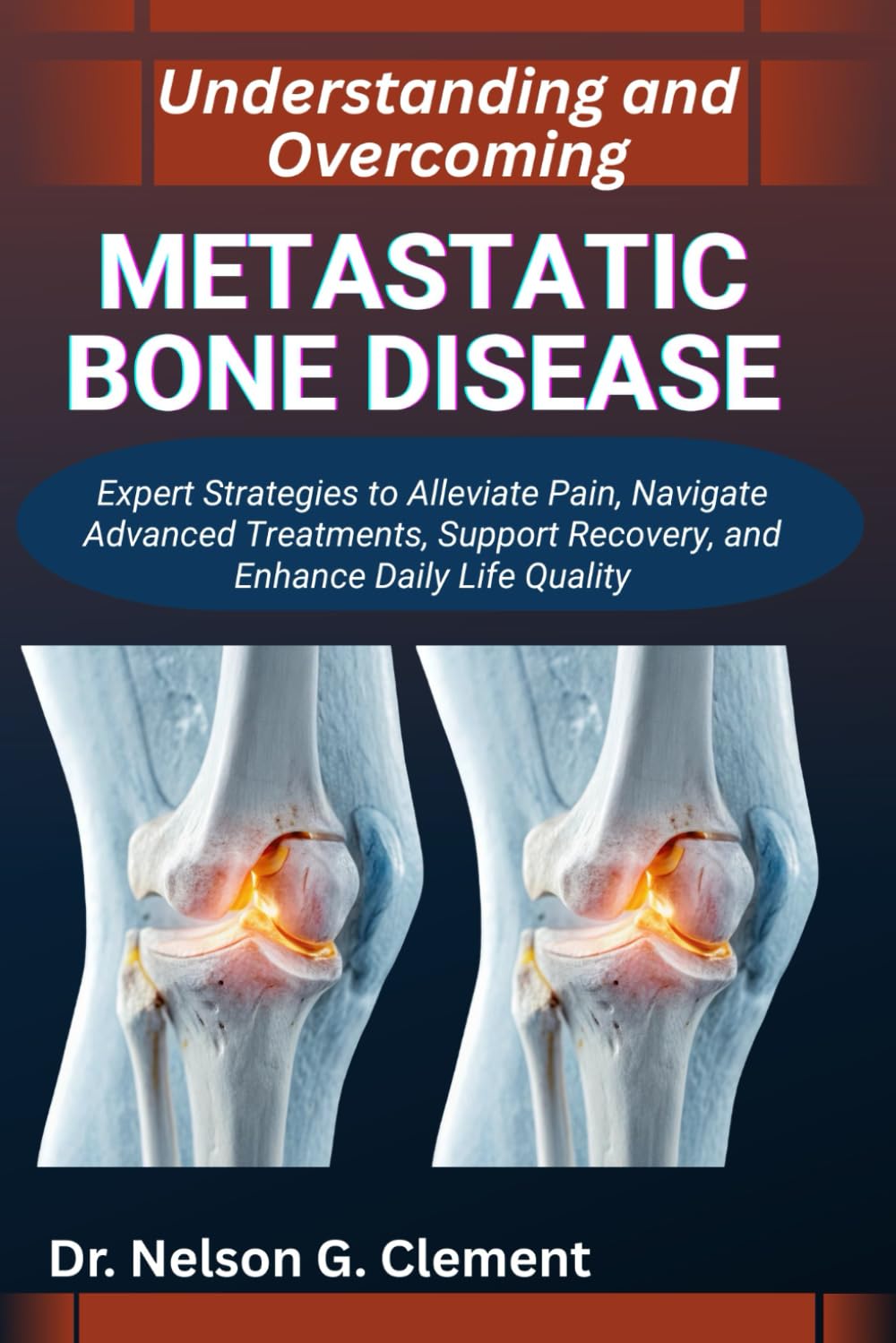 UNDERSTANDING AND OVERCOMING METASTATIC BONE DISEASE: Expert Strategies to Alleviate Pain, Navigate Advanced Treatments, Support Recovery, and Enhance Daily Life Quality