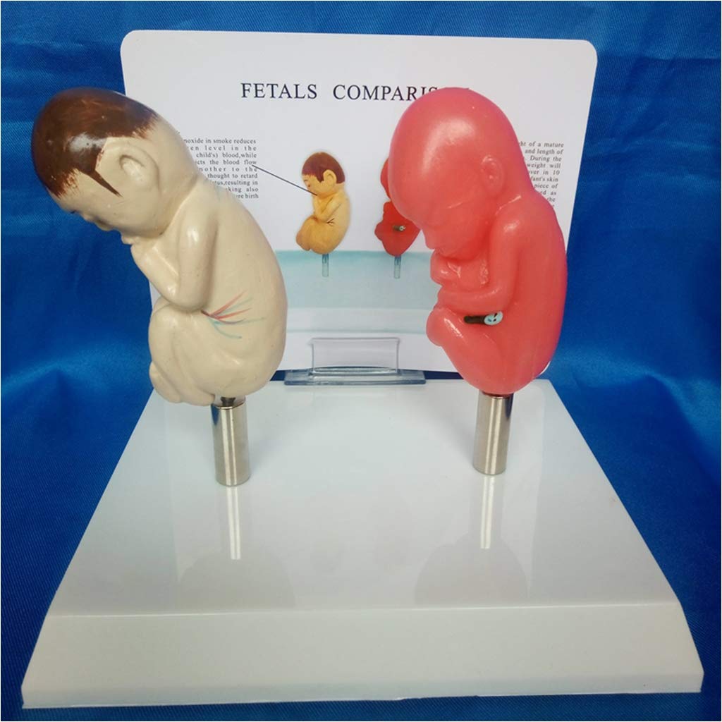 Model płodu-płód palący i normalny Model porównawczy płodu-materiał PCV modele naukowe anatomii człowieka-do wyświetlania w celach dydaktycznych model medyczny