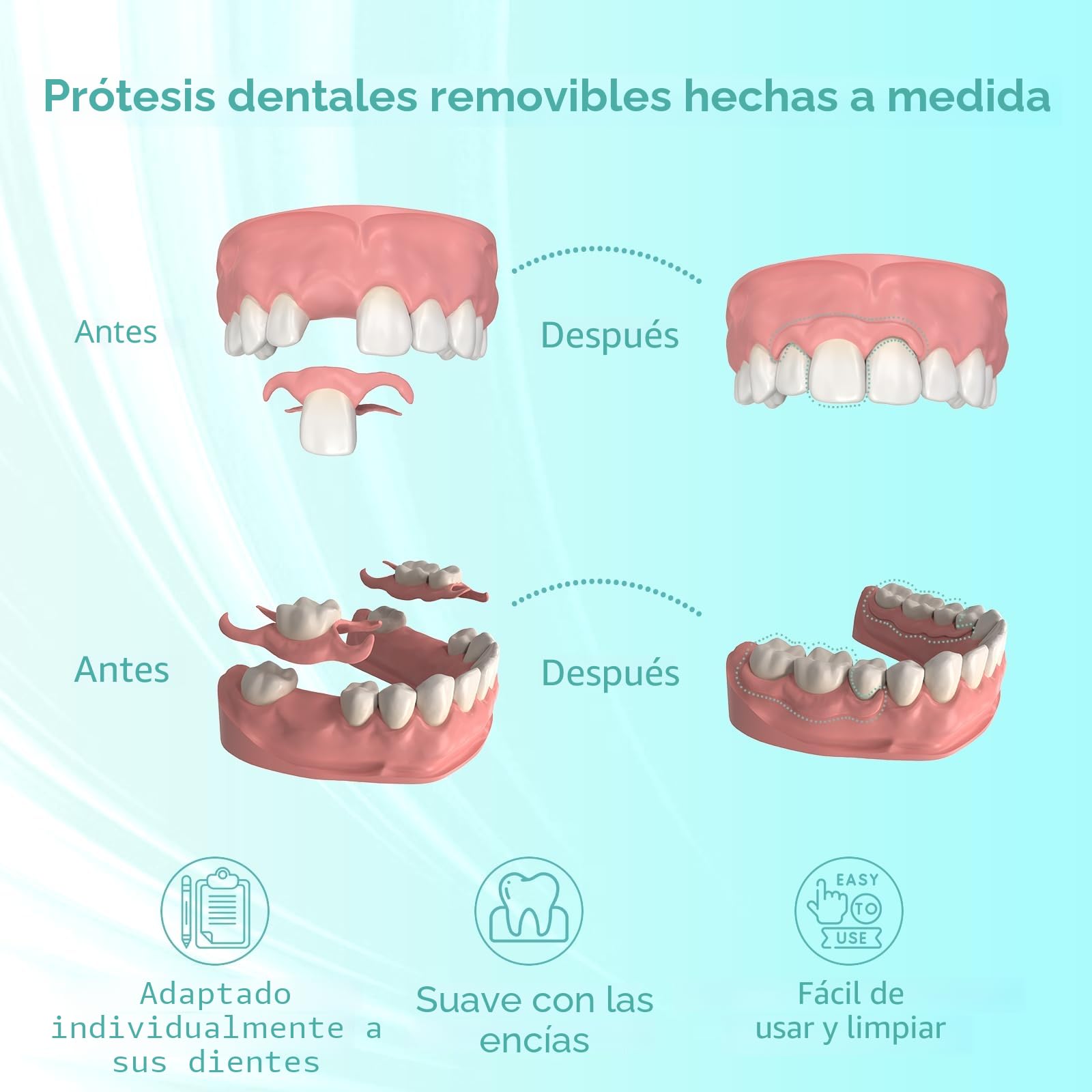 Prótesis parcial personalizada para espacios dentales – Prótesis dental provisional extraíble para hombres y mujeres, dentadura con ajuste perfecto. Fácil de usar para una sonrisa perfecta (1 diente)