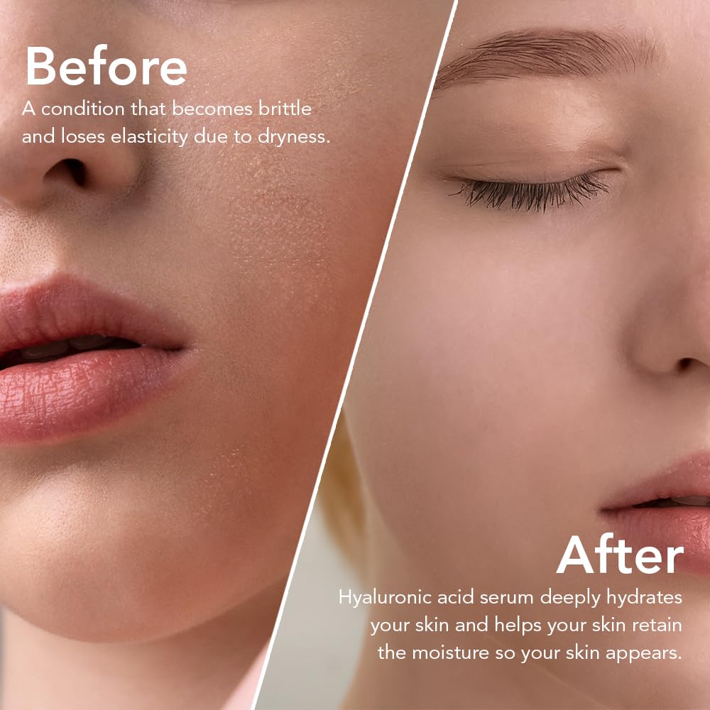 Olivia & Allison Hyaluronic Acid Serum 1.0 fl oz - With Panthenol + Olive Leaf Extract for Hydration & Calming Care - Image 5