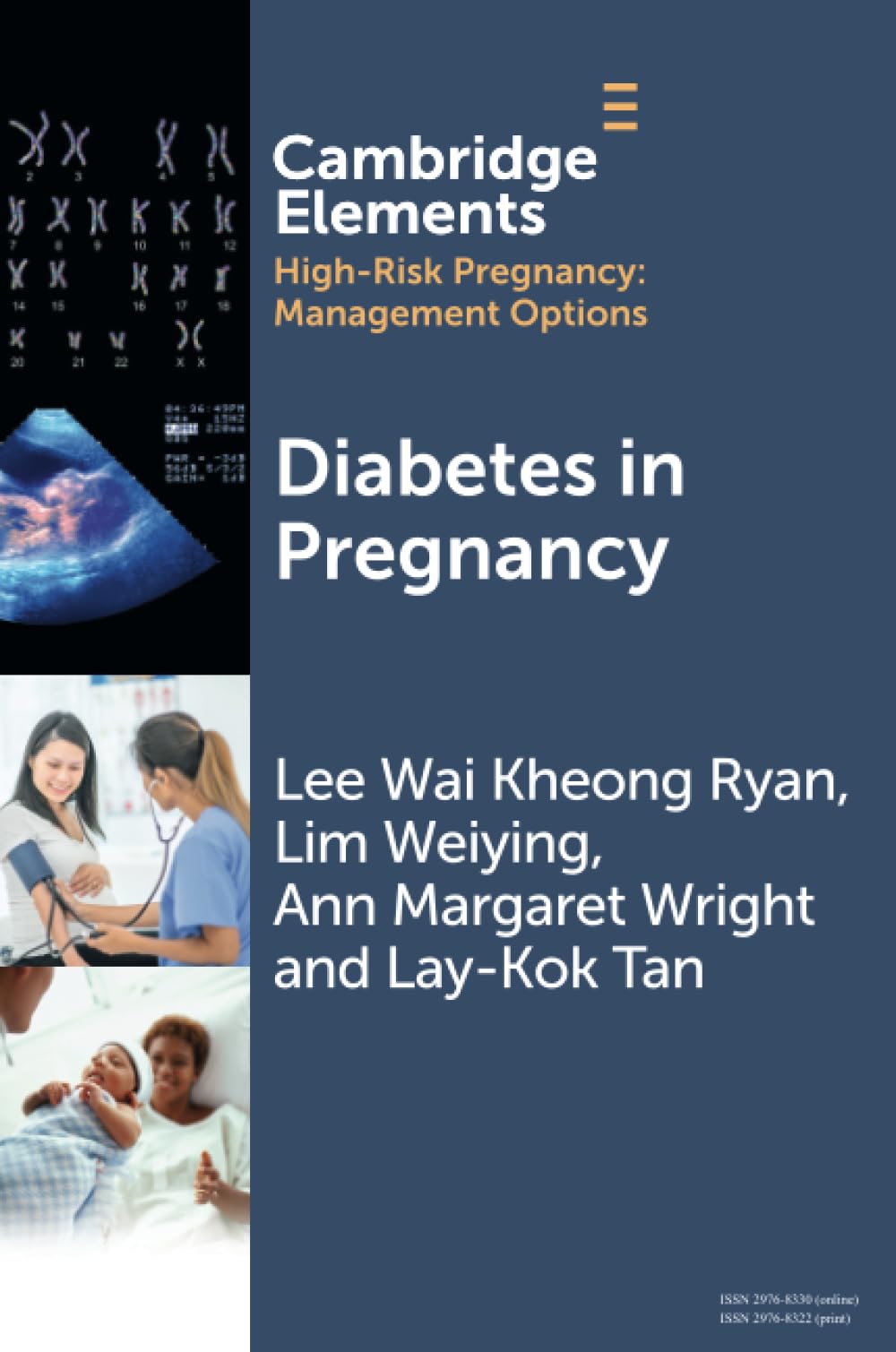 Diabetes in Pregnancy (Elements in High Risk Pregnancy: Management Options)