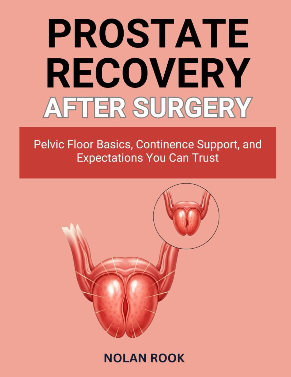 PROSTATE RECOVERY AFTER SURGERY: Pelvic floor basics, continence support, and expectations you can trust