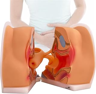 Gynecological Contraceptive Guidance Model, IUD Training Model, Cervical Uterus Vagina Ovary Structure Display, 1:1 Real Size, for Science Classroom Study