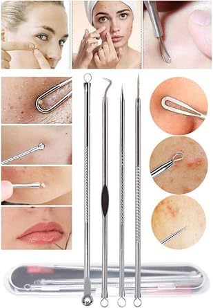 Stainless Comedone Acne - Blackhead Cleanser Set with 4 Boxes