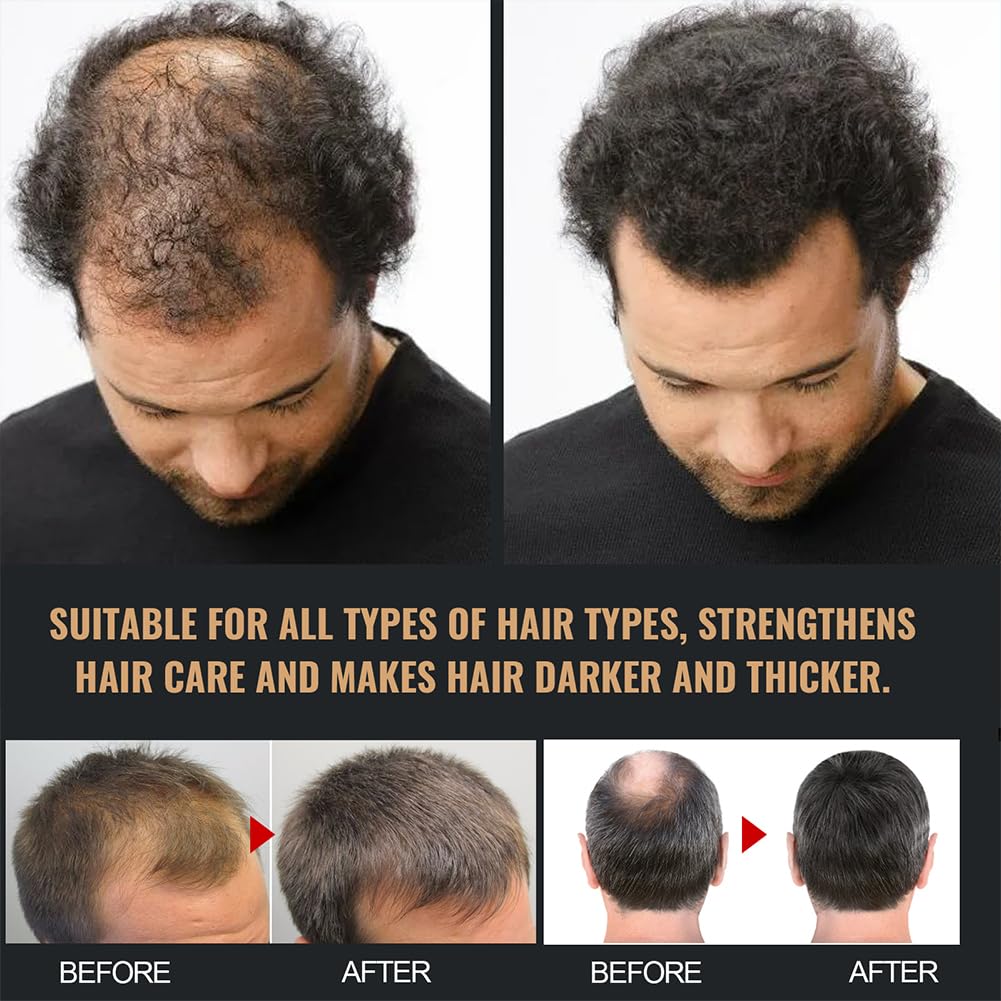 Champú activador de raíz para hombres pérdida de cabello espesor repara suaviza fortalece