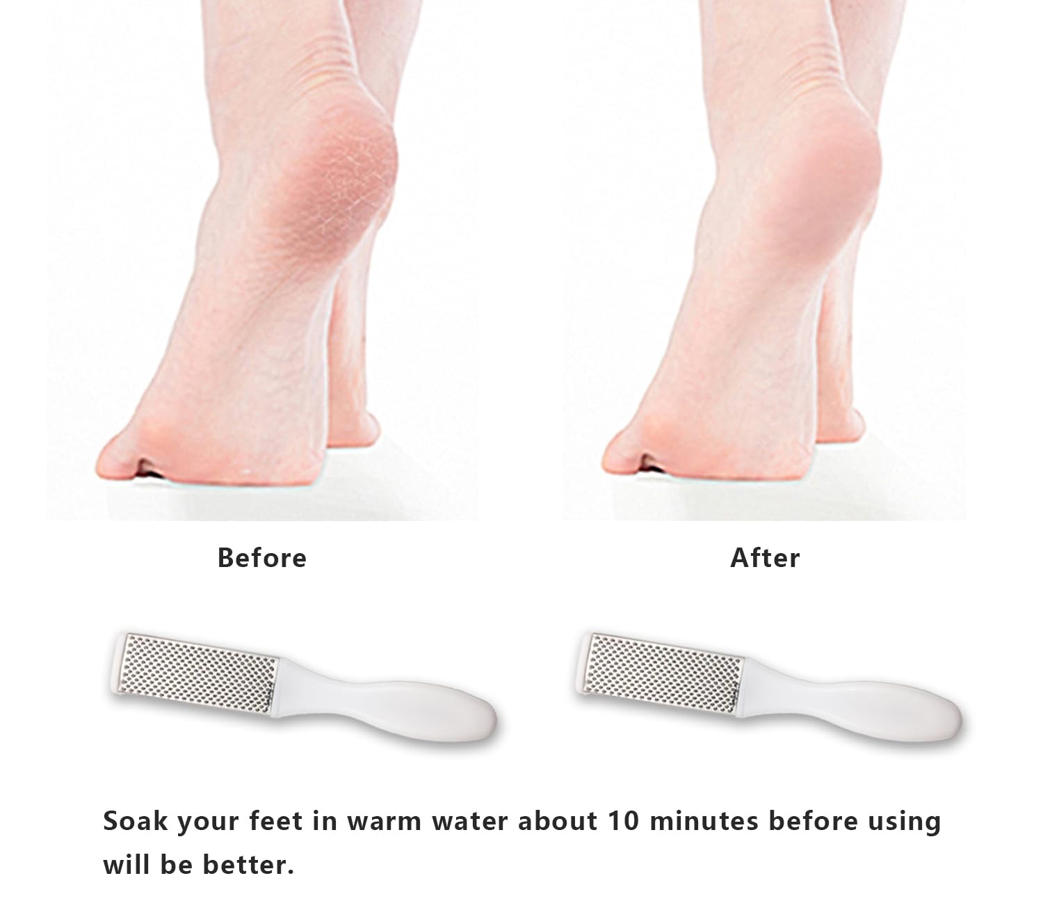 Professional Foot Files Callus Remover,Foot Scrubber for Dead Skin,Stainless Steel Foot Rasp-White(1 Pack) - Image 4