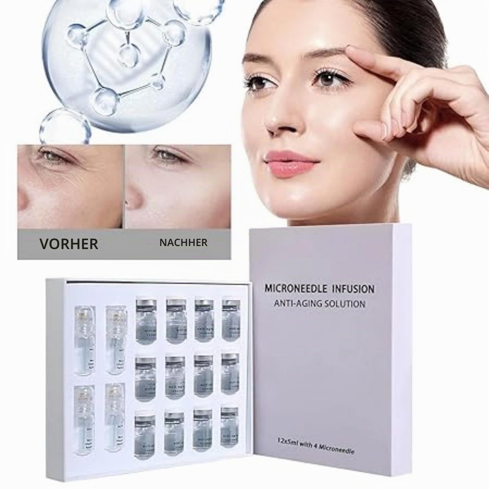 Micro Infusions System, Micro Infusion System Original, Mikroinfusionssystem Gesicht, Mc Micro Infusion System, Anti-Aging & Smooth Wrinkles Facial Serum (4 Mikronadeln + 12 Flaschen)