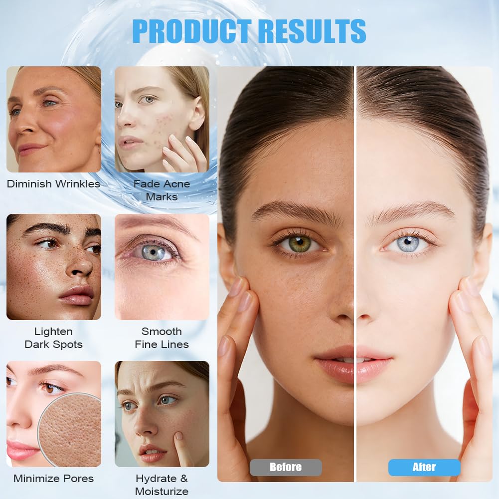 Vicloon 36-pinowy wkład do Beauty pen, 15 wymiennych wkładów z igłami do automatycznych wałków z mikronakłuwaniem, elektryczne pióra do mikronakłuwania, wymienne igły do ​​urządzeń do mikronakłuwania