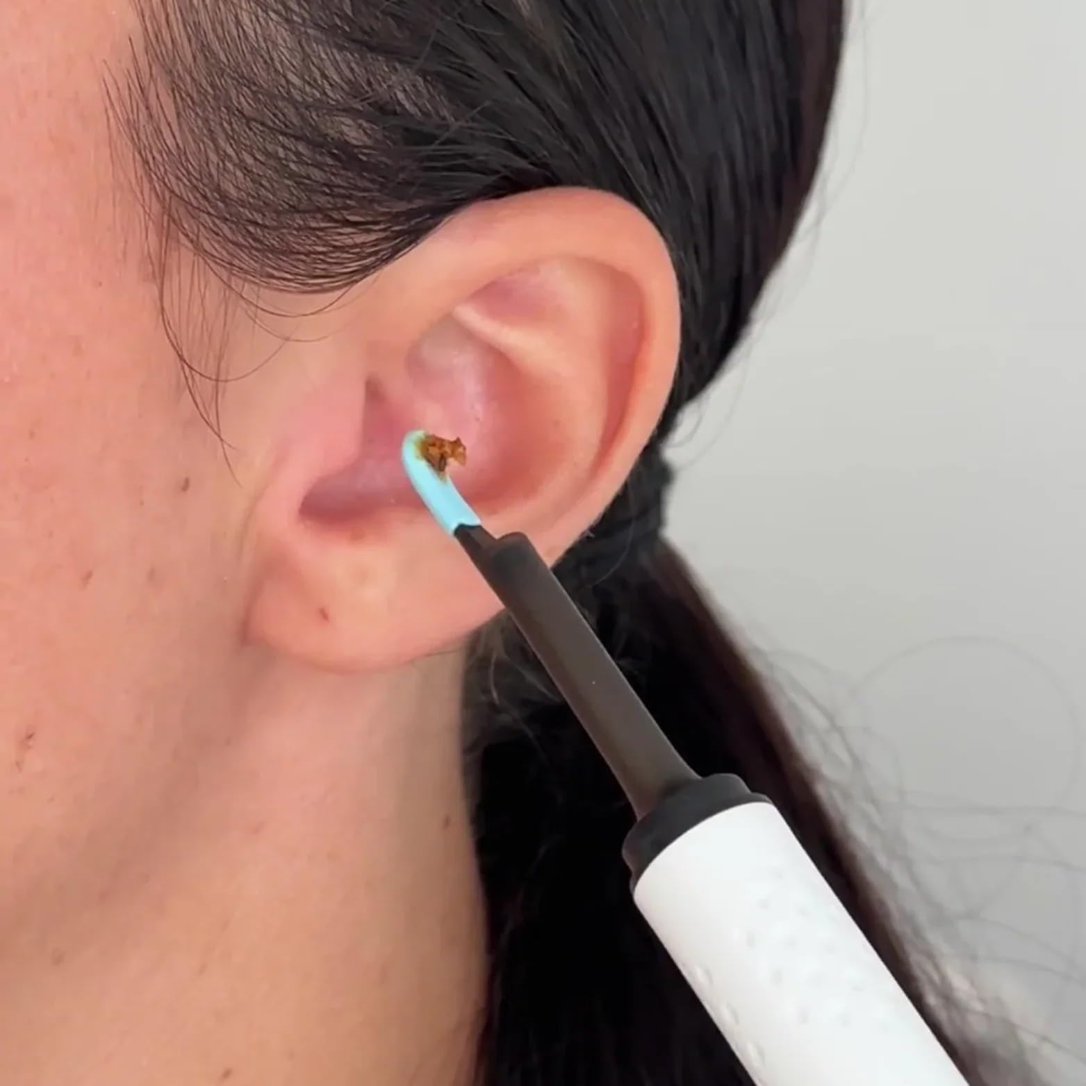 Earo Vision 1.0 - Hygiène Auditive Révolutionnée A Vie Otoscope Avec Cure Caméra Oreille 1080P HD Nettoyage, 3,5 mm Etanche, Compatible iOS et Android (noir)