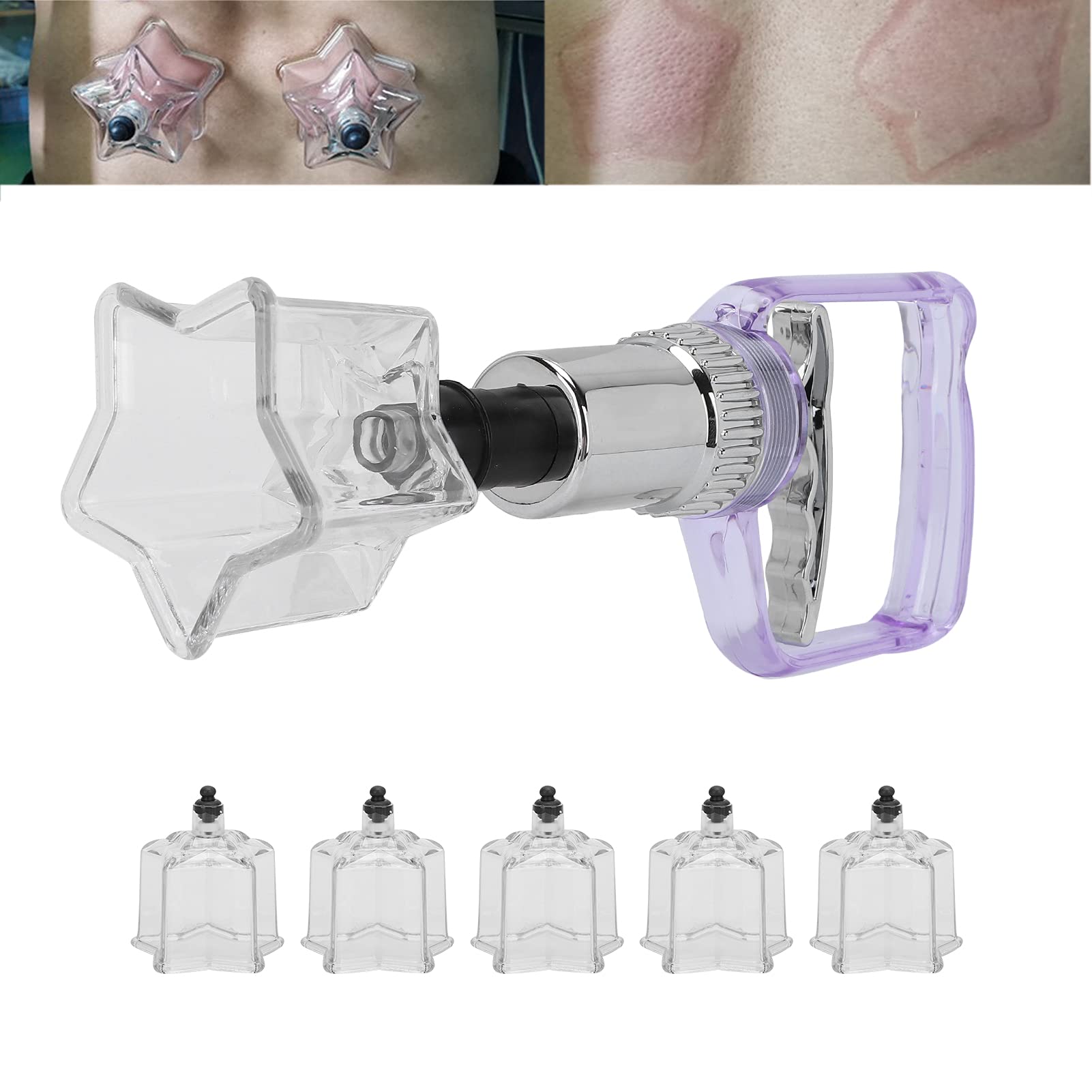 Schröpfset, Lure Cups Körper Fünfzackiges sternförmiges Schröpfset Schmerzlinderungsmassage Schröpftherapie-Set Pumpenpistole Schröpfset Chinesisches Schröpftherapie-Set Professionelles Massage-Schr