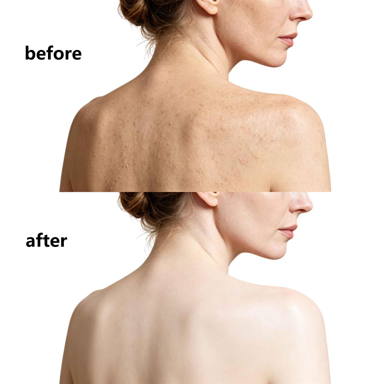 Peeling-Körperpeeling für holprige Haut, feuchtigkeitsspendendes Kurkuma-Körperpeeling, sanftes, glättendes, peelendes, aufhellendes Körperpeeling, tiefes Peeling-Gesichtspeeling (4pcs)