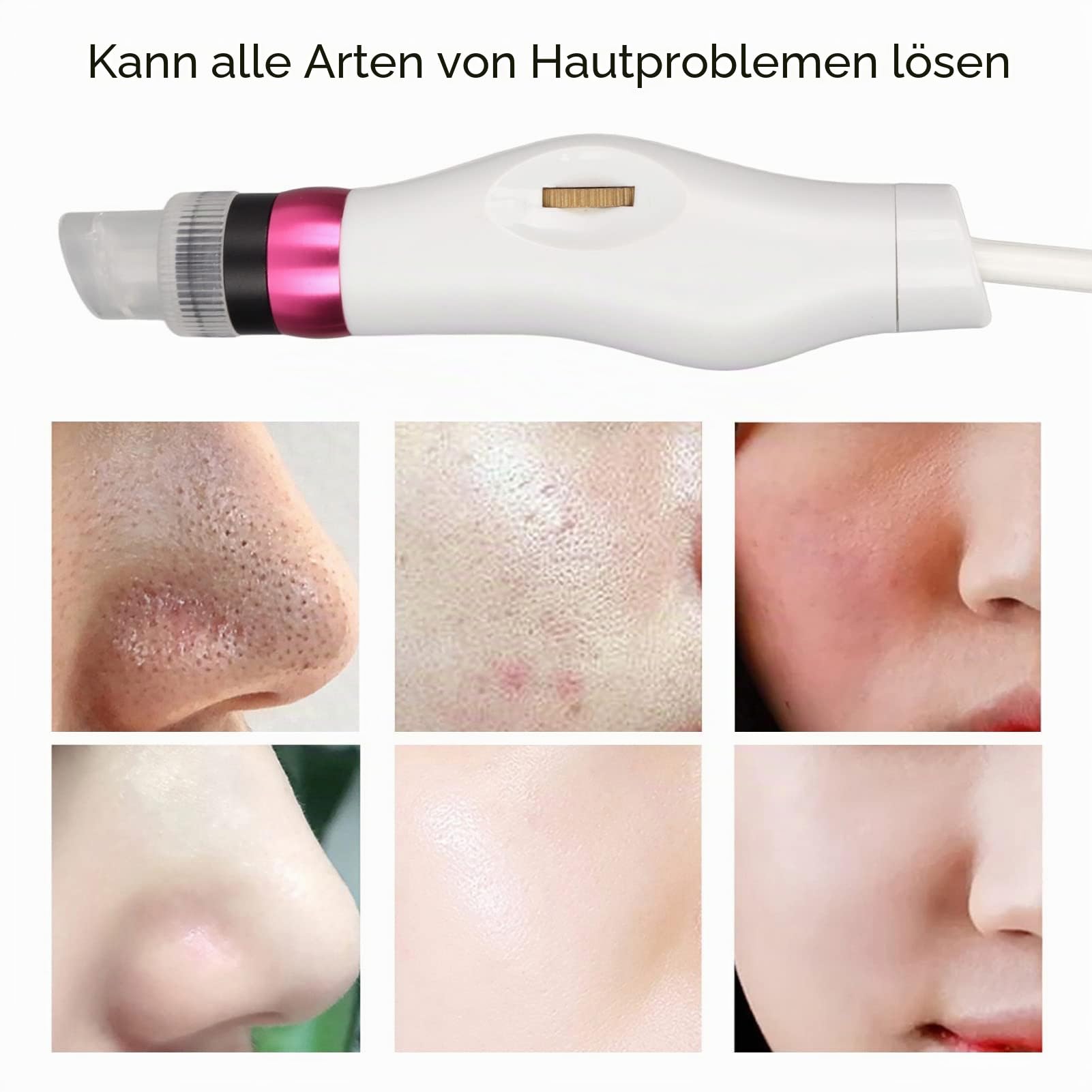 Mitesser-Entferner, Porenstaubsauger, 3 Saugstärken, 8 Sonden, wiederaufladbares USB-Mitesser-Staubsauger-Set, Gesichtsporenreiniger, elektrisches Extraktionswerkzeug für Frauen
