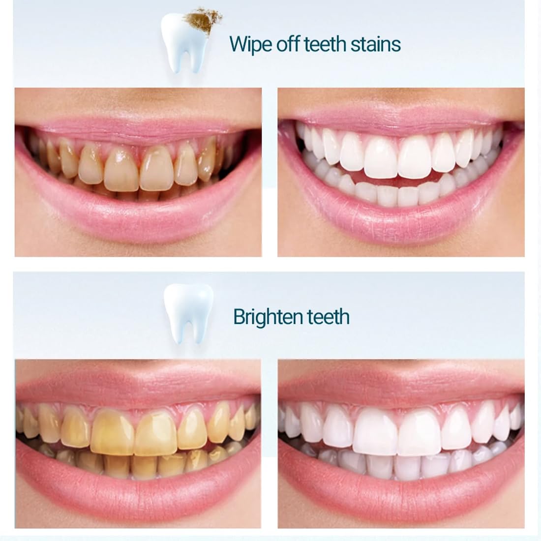 1 Scatola Carta Vetrata Dentale, Strisce Abrasive Interdentali, Carta Abrasiva Dentale Per Fessure, Strisce Per Lucidare I Denti Portatili, Lucidatura Dei Denti, Rimozione Del Tartaro