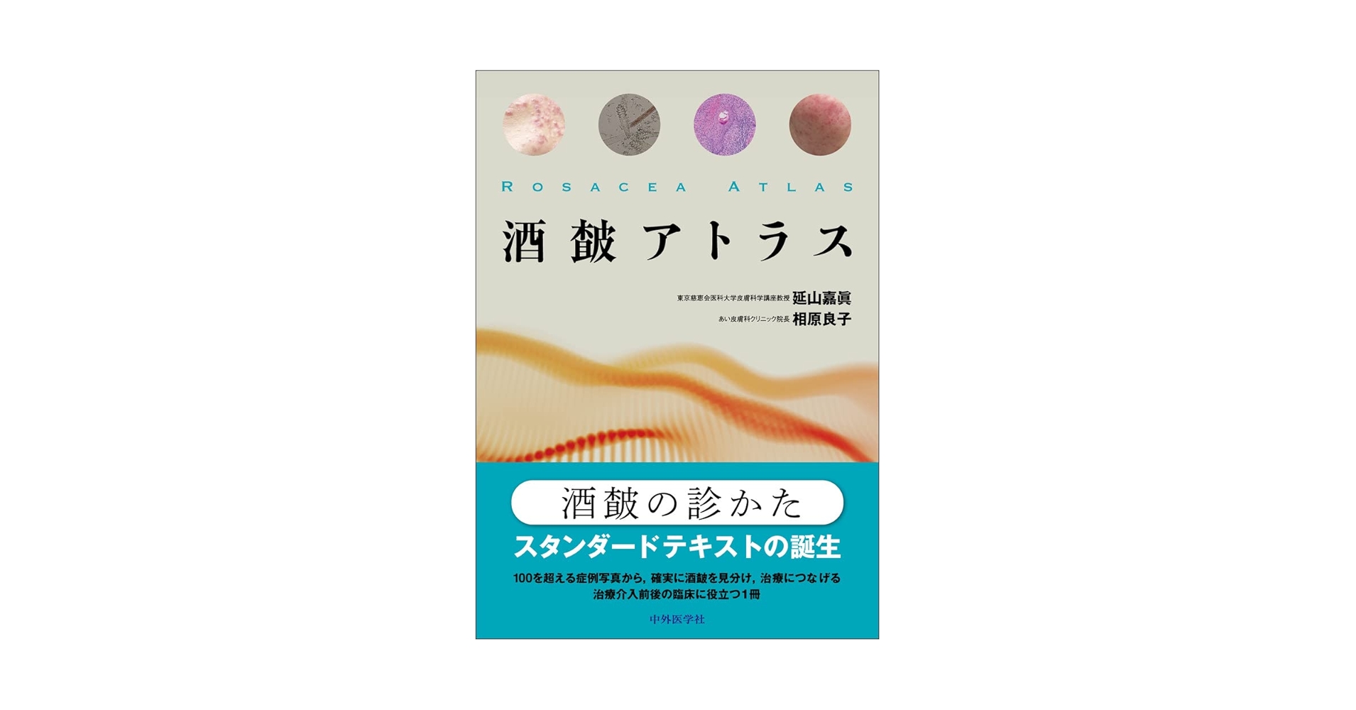 皮膚科診療カラーアトラス大系 2 皮膚科診療カラーアトラス大系 （2）』（鈴木 啓之,神崎 保