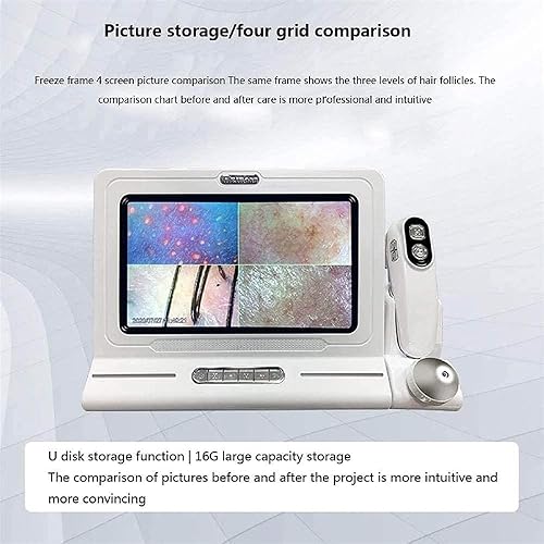 Miniatura 5 de Analizador de pelo de piel, probador de cabello de 11 pulgadas, pantalla LCD HD, microscopio digital, analizador de diagnóstico de piel con 50 x 200