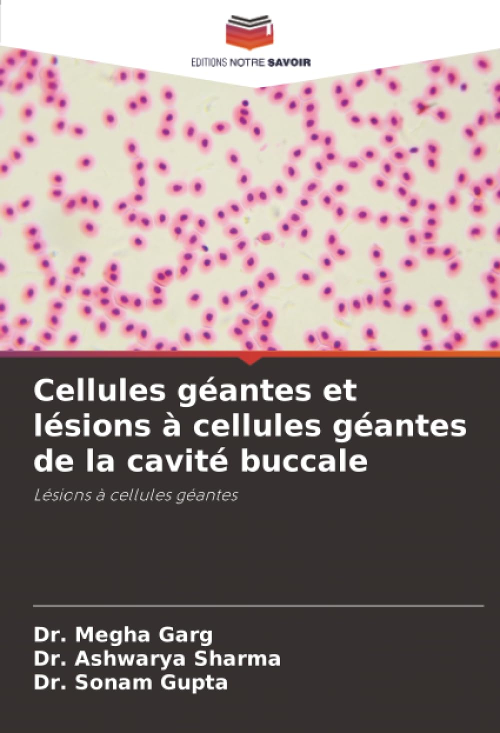 Cellules géantes et lésions à cellules géantes de la cavité buccale: Lésions à cellules géantes