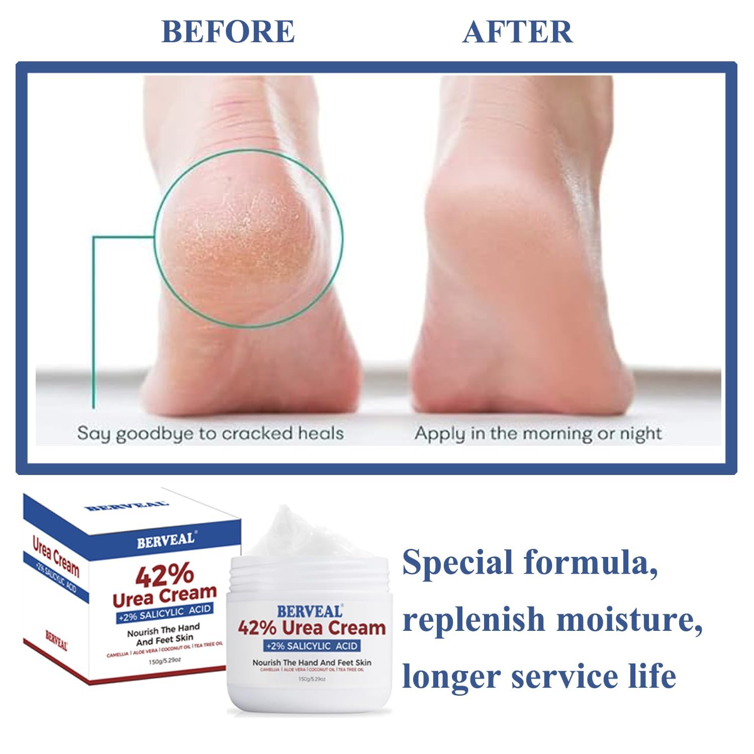 Urea Cream with 2% Salicylic Acid Foot Cream for Dry Cracked Heels Moisturizes and Removes Corns, Calluses, Dead Skin - Image 4