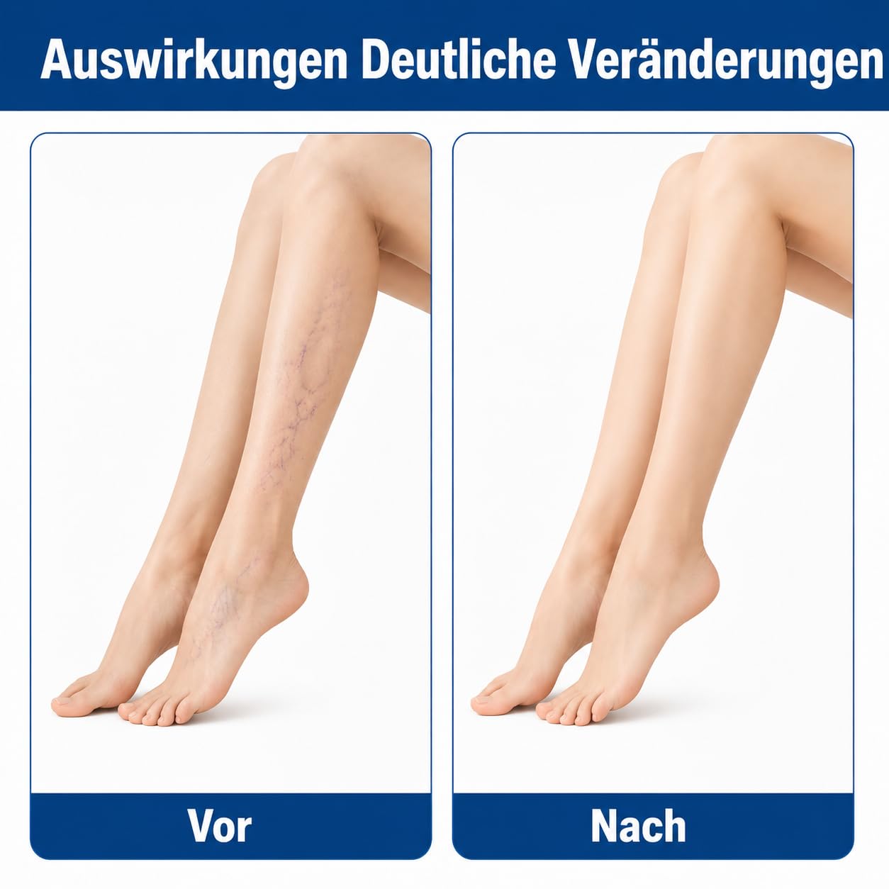 Mikronadel-Pflegepflaster für Beine—Erfrischende, hautverträgliche Klebepflaster für müde Beine, ideal für tägliche Anwendung, Reisen & Büro (1 Stück)