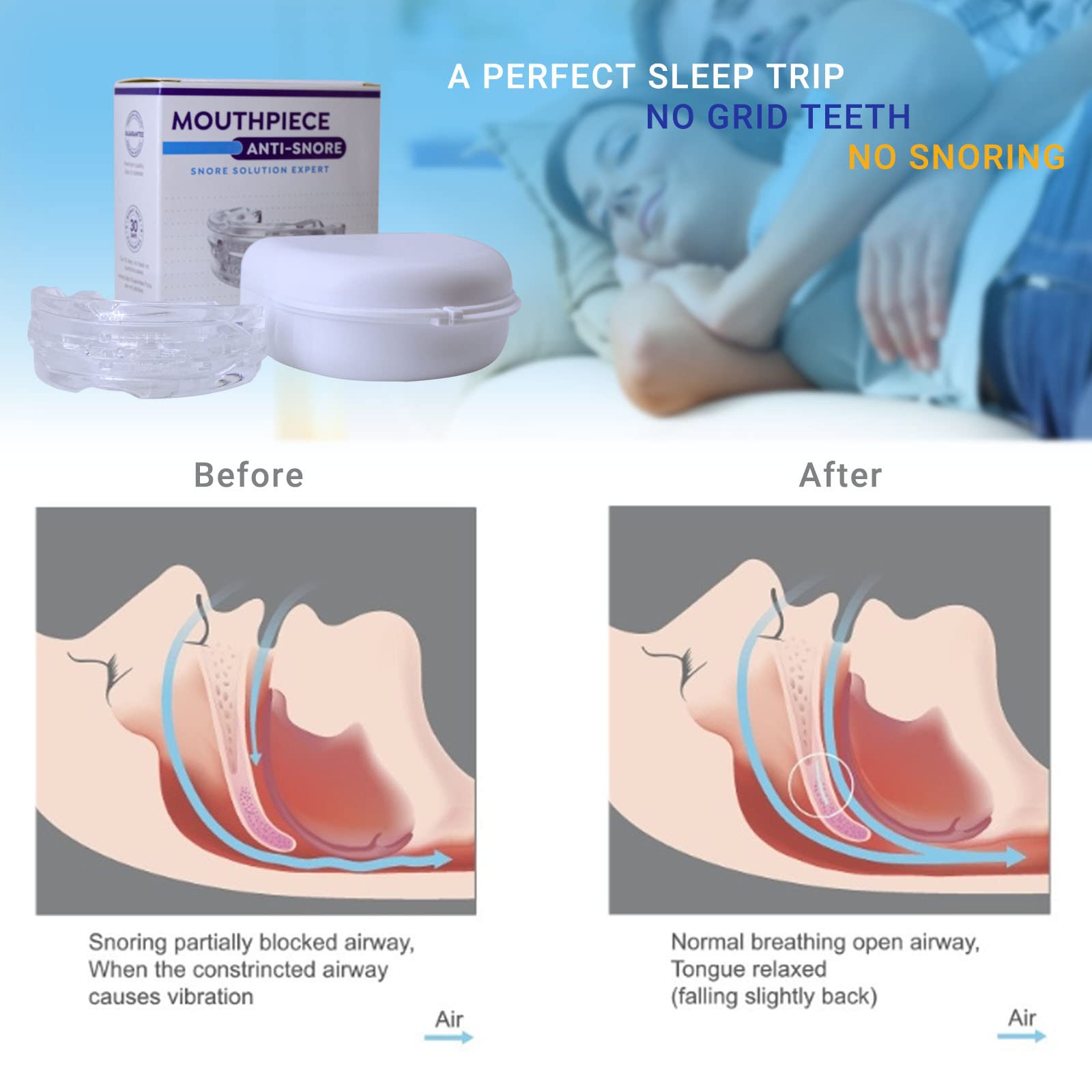 Osmosnorlite Osmo SnorLite 2.0.SnoreStop - Anti Snoring Therapy (blau)