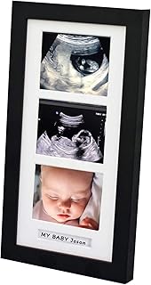 Triple Ultrasound Picture Frames, Sonogram Picture Frame 3 Photos,Pregnancy Announcements,Pregnancy Gifts for First Time Moms,First Time Mom Gift,Black,Ultrasound Photo Album