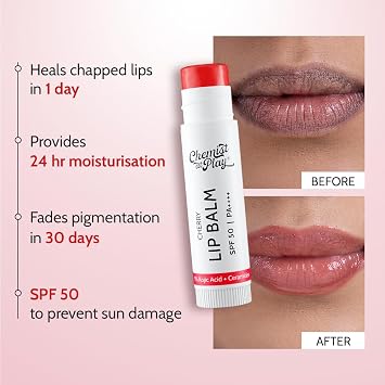 Chemist At Play's Cherry Lip Balm| Repairs Chapped Lips Brightens Dark Lips | 1% Kojic Acid| SPF 50 PA++++| For men and women| 4.5gm