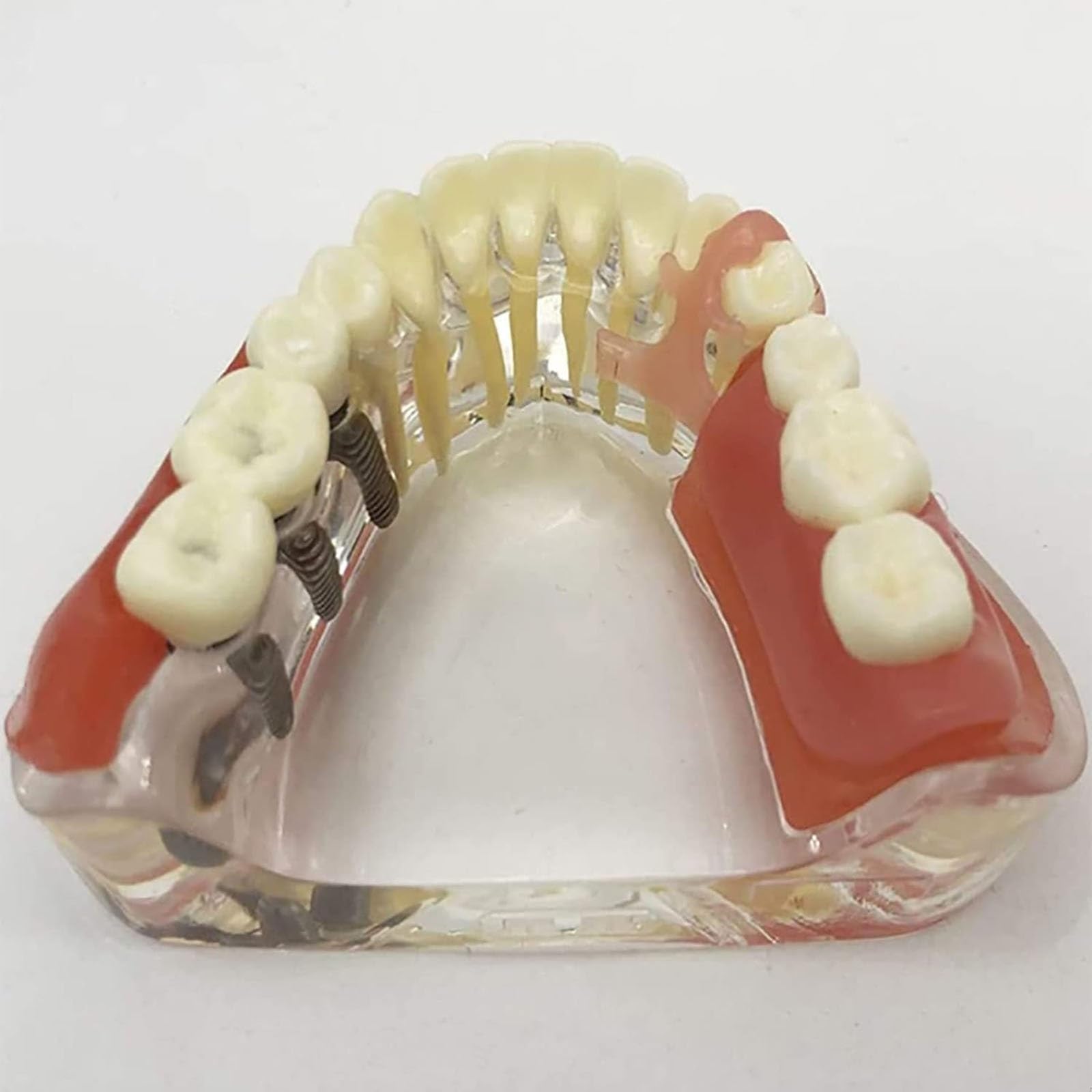 Modello di denti dentali per l'insegnamento, gengive e protesi rimovibili e strumenti dimostrativi per lo studio e la formazione