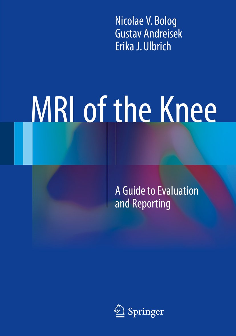 MRI of the Knee: A Guide to Evaluation and Reporting (English Edition)