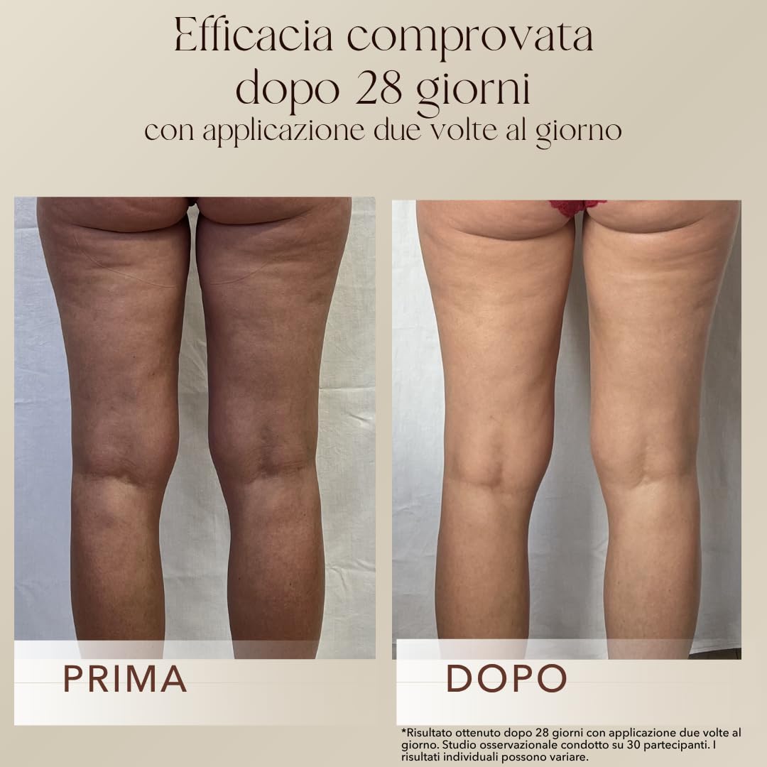 mellow NOIR Body Contour Cream 200 ml – Crema per il corpo contro la cellulite e la pelle flaccida – per contorni solidi su addome, gambe e braccia – assorbe rapidamente senza grasso – Cosmetici