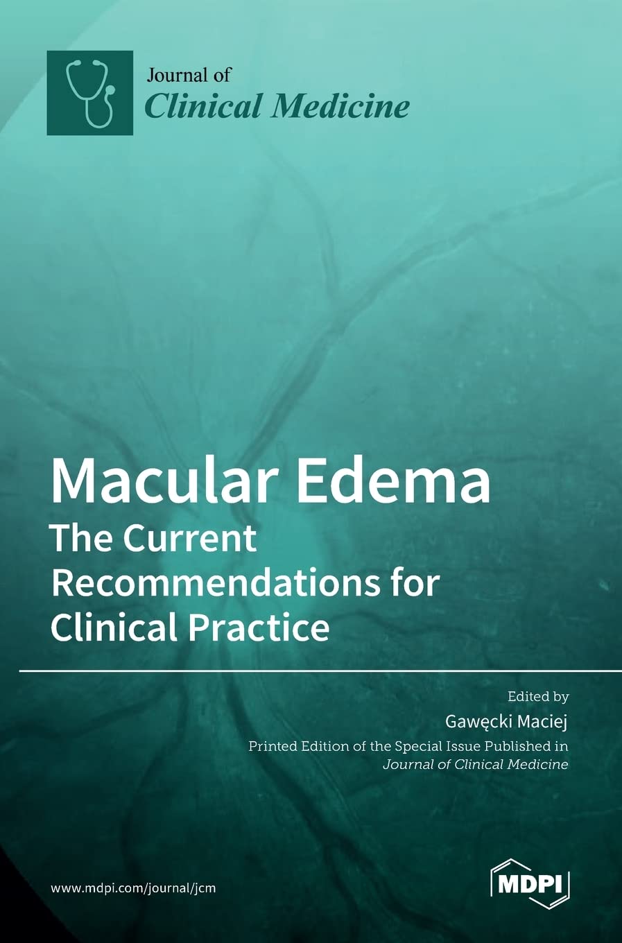 Macular Edema: The Current Recommendations for Clinical Practice